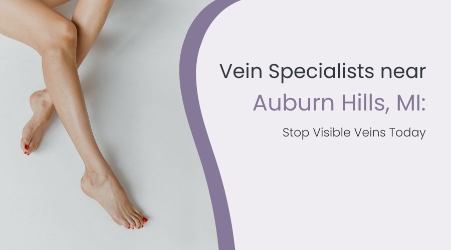 Vein Specialists near Auburn Hills, MI: Stop Visible Veins Today