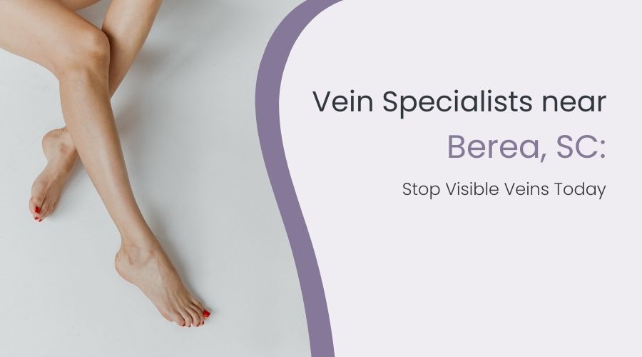 Vein Specialists near Berea, SC: Stop Visible Veins Today