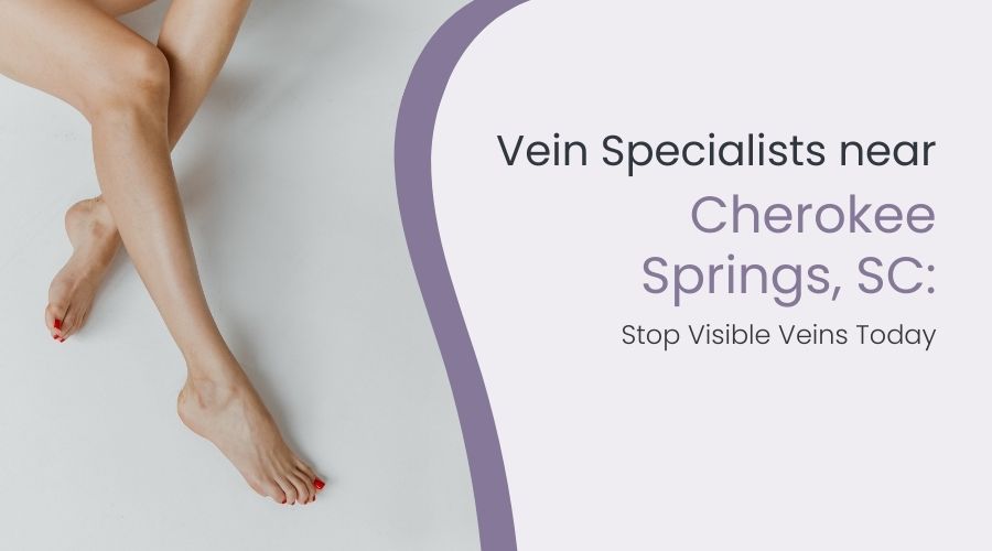 Vein Specialists near Cherokee Springs, SC: Stop Visible Veins Today