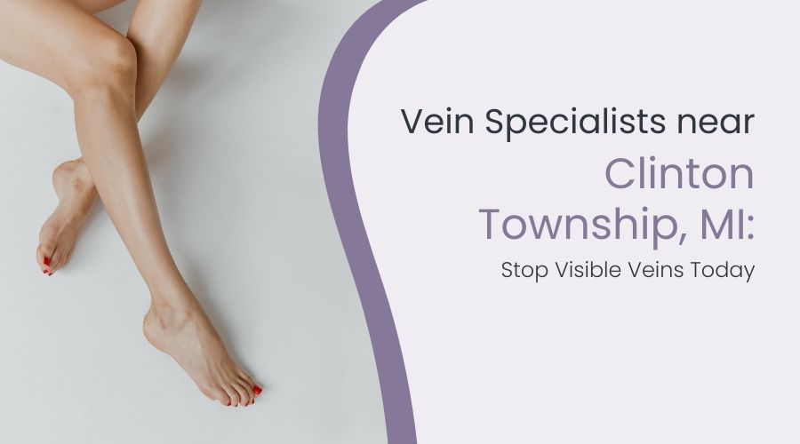 Vein Specialists near Clinton Township, MI: Stop Visible Veins Today