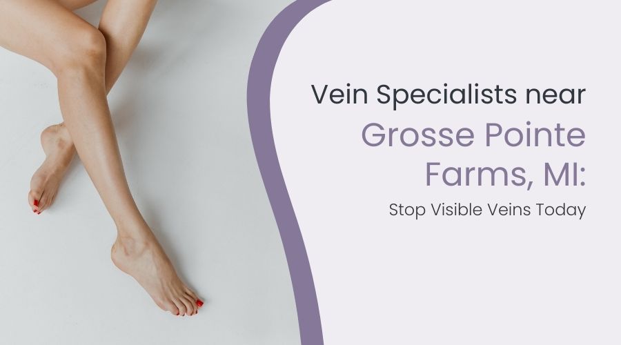 Vein Specialists near Grosse Pointe Farms, MI: Stop Visible Veins Today