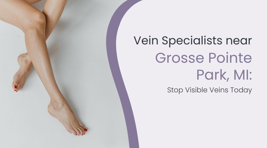 Vein Specialists near Grosse Pointe Park, MI: Stop Visible Veins Today