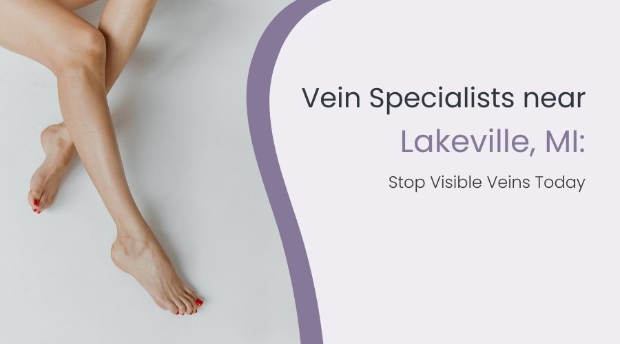 Vein Specialists near Lakeville, MI: Stop Visible Veins Today