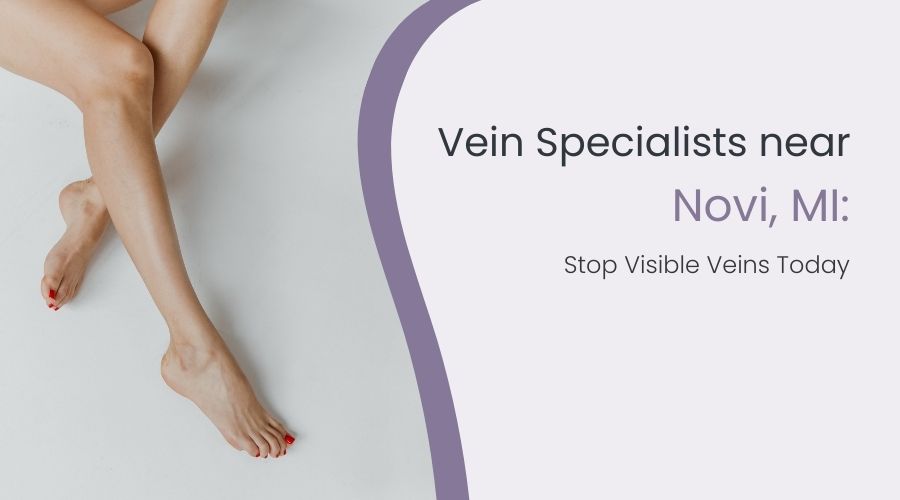 Vein Specialists near Novi, MI: Stop Visible Veins Today