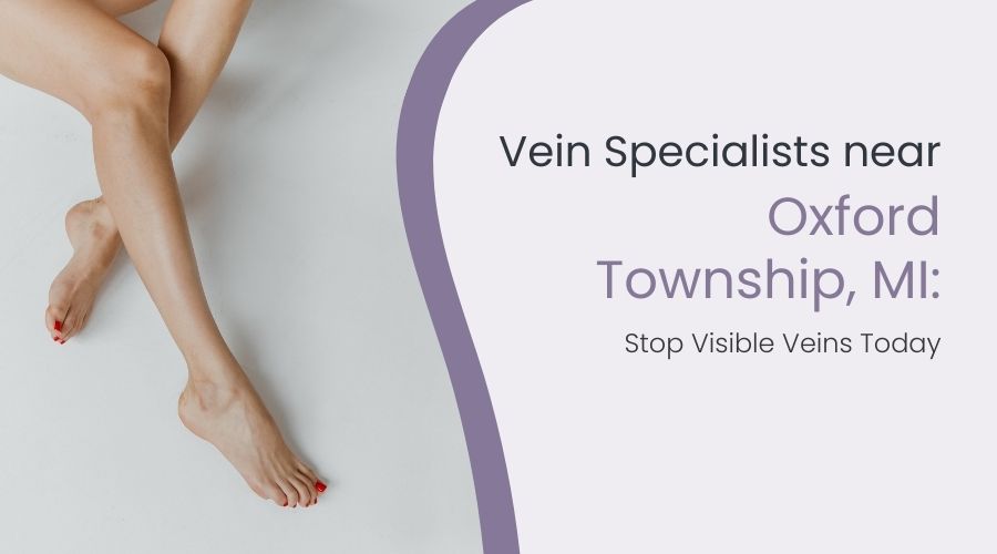 Vein Specialists near Oxford Township, MI: Stop Visible Veins Today