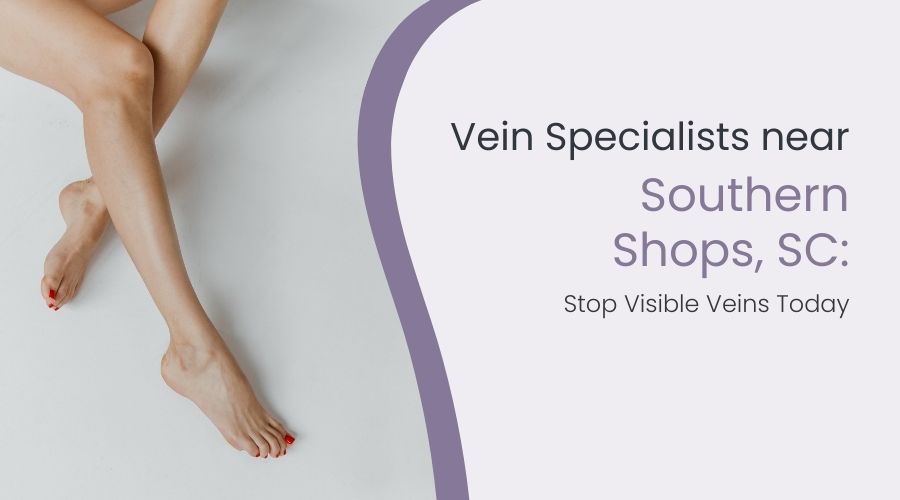 Vein Specialists near Southern Shops, SC: Stop Visible Veins Today