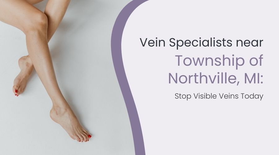 Vein Specialists near Township of Northville, MI: Stop Visible Veins Today