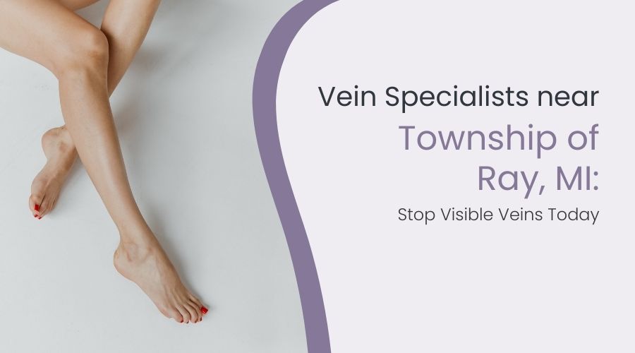 Vein Specialists near Township of Ray, MI: Stop Visible Veins Today