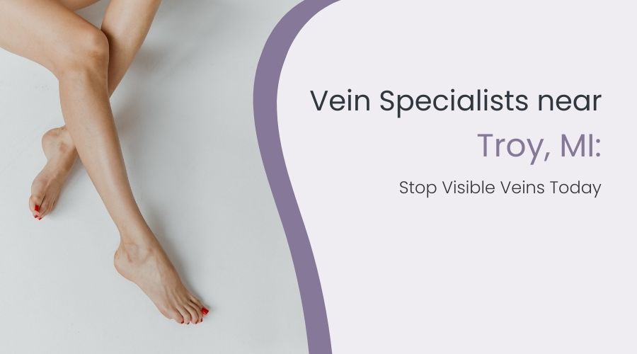 Vein Specialists near Troy, MI: Stop Visible Veins Today